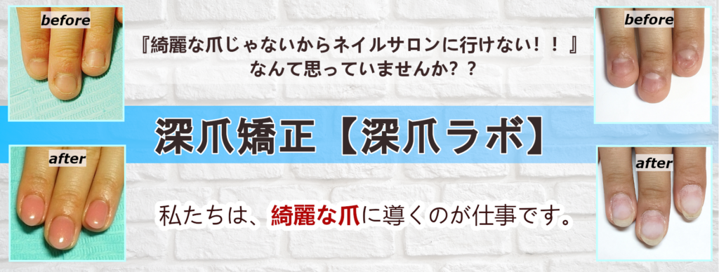 深爪矯正 深爪ラボ 名古屋市北区プライベートネイルサロン Nailroom Be 長持ちネイルパーフェクトフィルイン導入サロン
