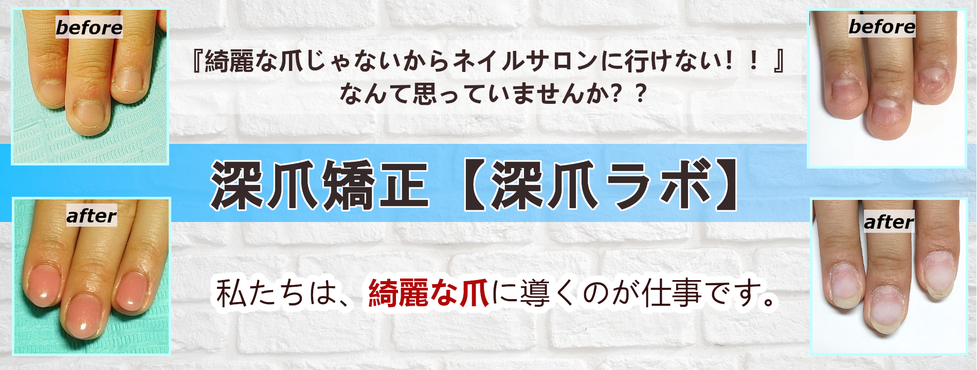 名古屋市　北区　自宅ネイルサロン　深爪矯正　深爪ラボ　パーフェクトフィルイン